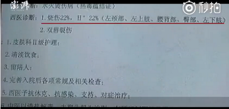 【品牌整形】重庆时光赢得各界人士一致好评的医院“全球总决赛官网”(图1) 全球总决赛官网