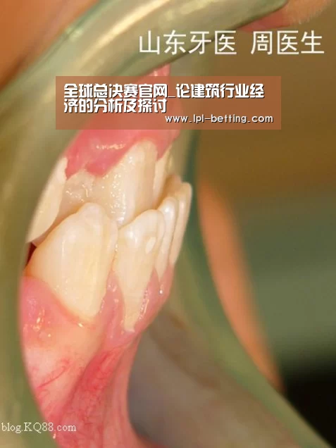 全球总决赛官网